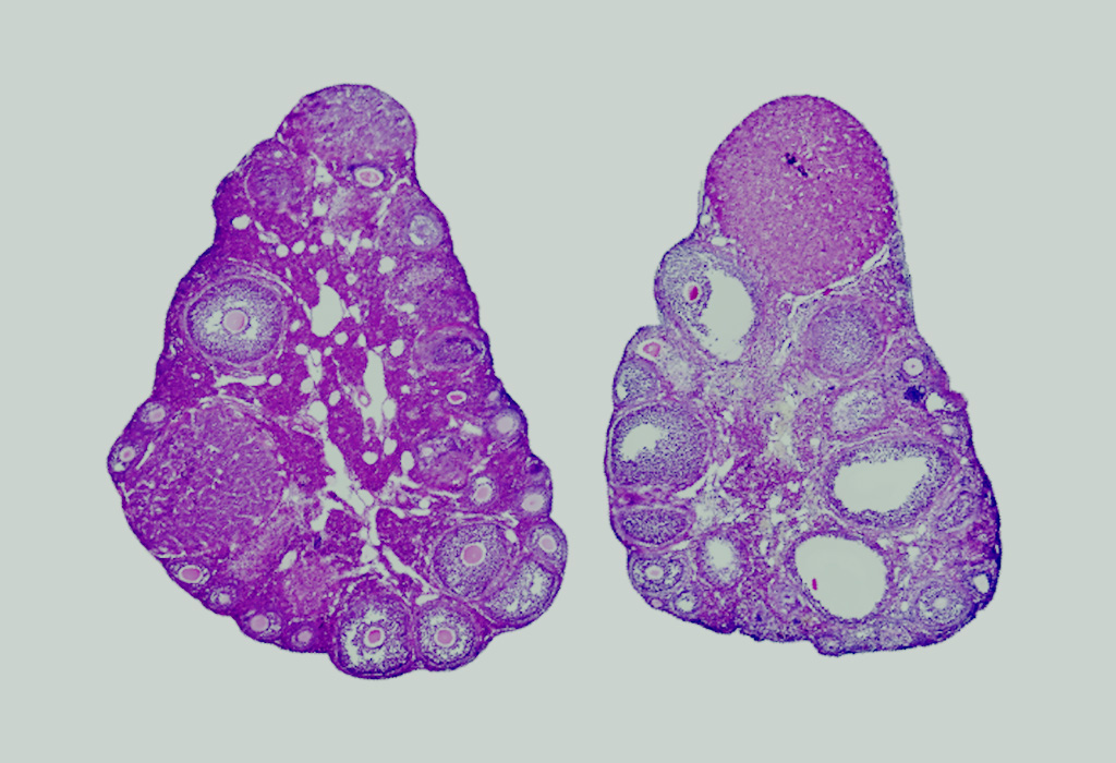 A single-cell atlas of the aging murine ovary